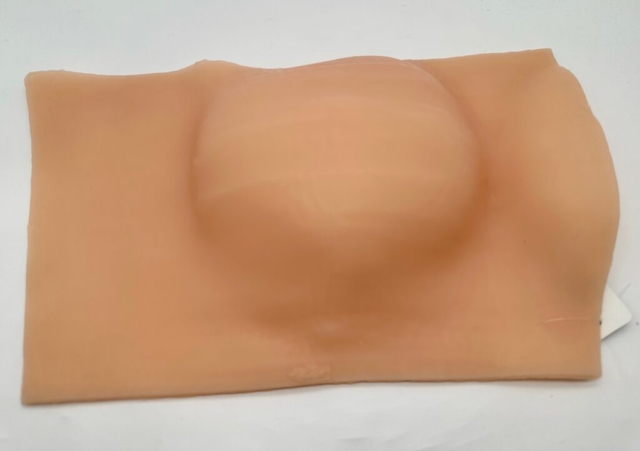 Custom Silicone Bolus Peach Breast